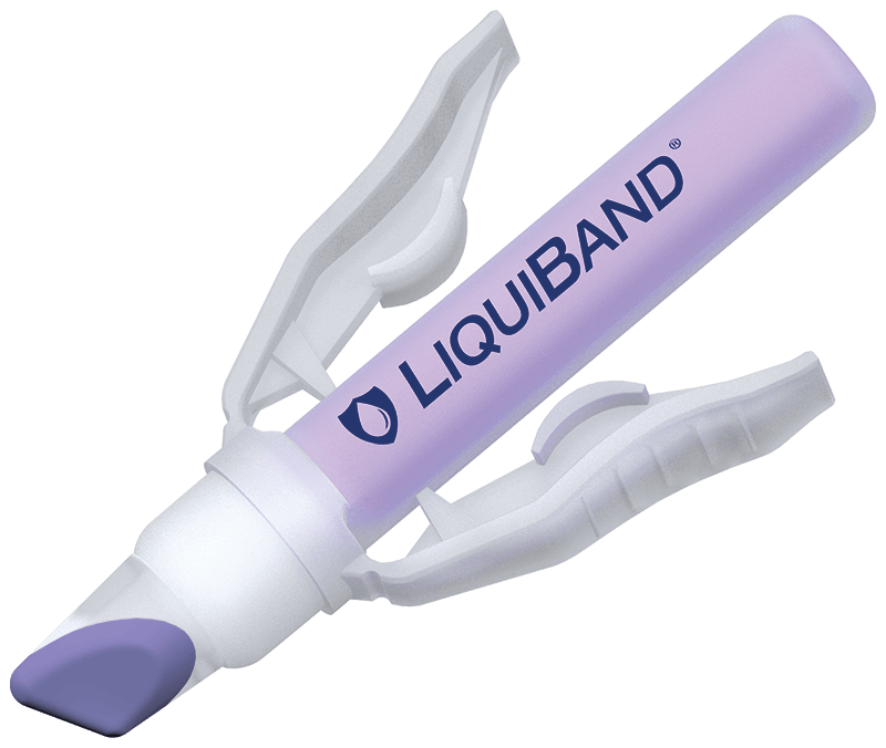 Controlled applicator tip LiquiBand Rapid