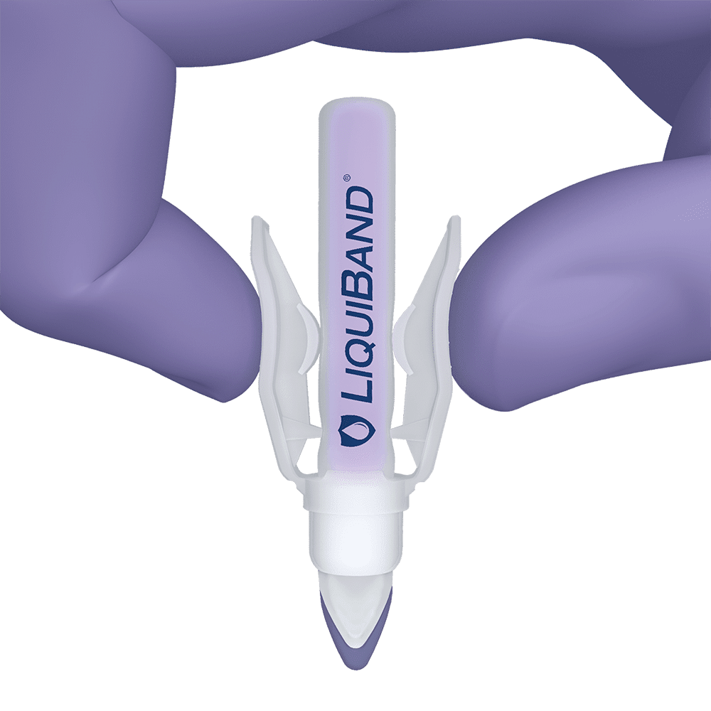 Rapid application guide Rapid application guide